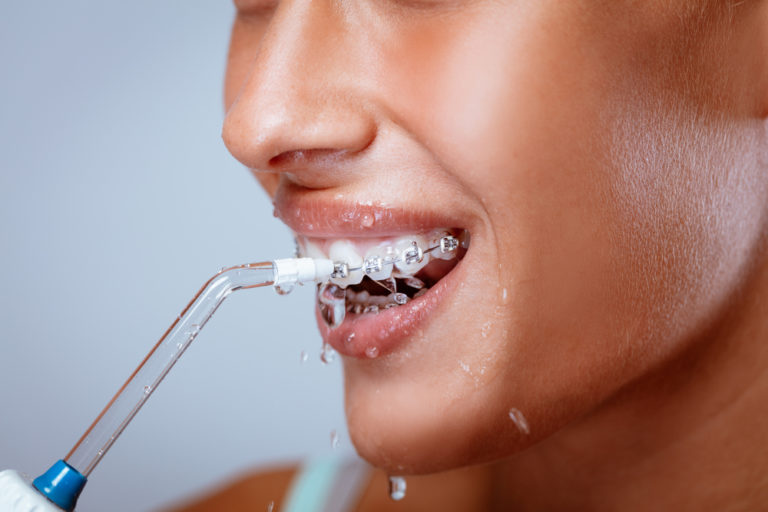 is-it-safe-to-use-a-waterpik-for-braces-innovative-orthodontic-centers